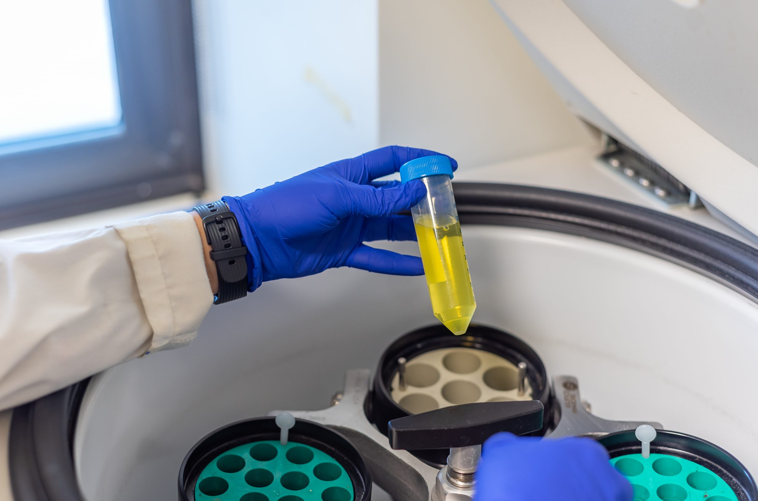 ¿Qué es una centrifuga? Kalstein